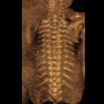 fetal spine