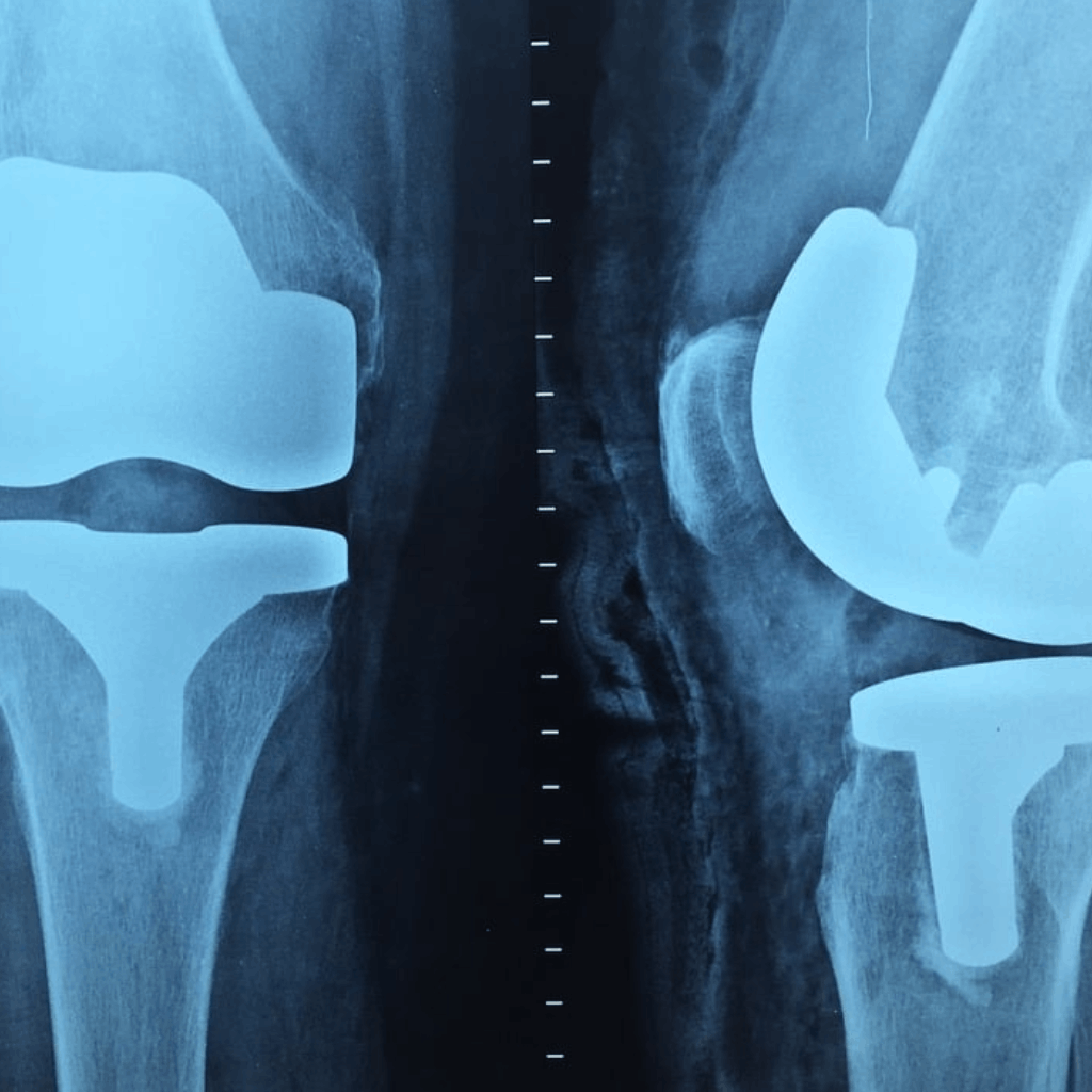 Ortopedia, traumatologia ortopedia