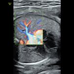 radiantflow fetal heart
